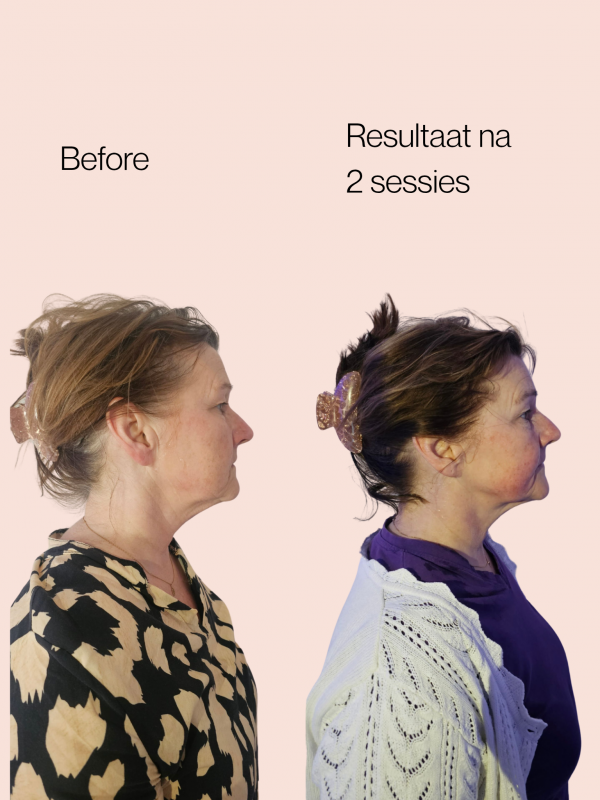 Resultaat na 2 sessies Anita 2